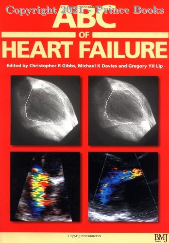 abc of heart failure