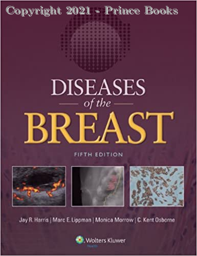 Diseases of the Breast 2vol set, 5e