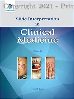 SLIDE INTERPRETATION IN CLINICAL MEDICINE VOLUME IV, 1e