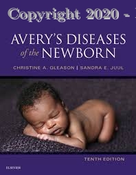 Avery's Diseases of the Newborn 3 vol set, 10e