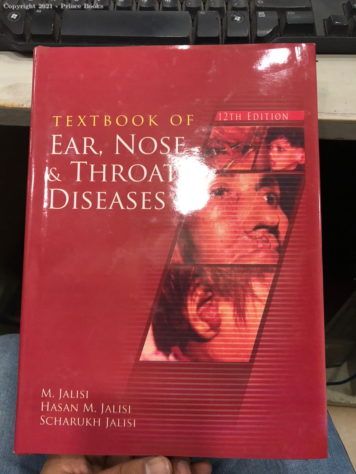 Textbook of Ear, Nose and Throat Diseases, 11e