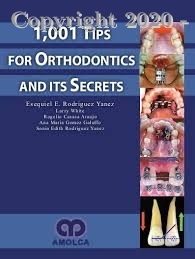 1,001 tips for orthodontics and its secrets, 1e